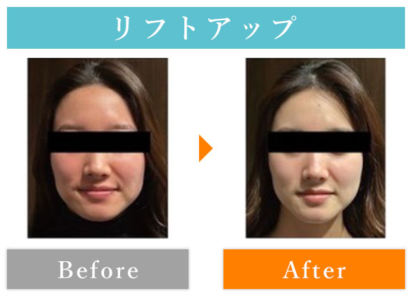ビフォーアフター