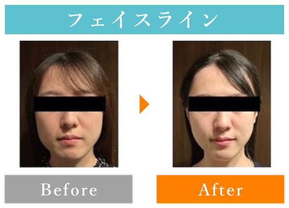 ビフォーアフター