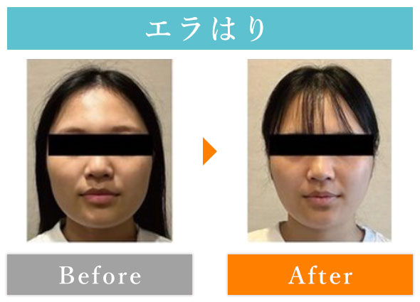 ビフォーアフター